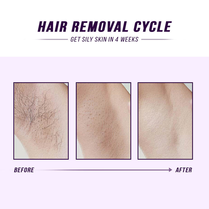 Laser IPL Hair Removal by eterus